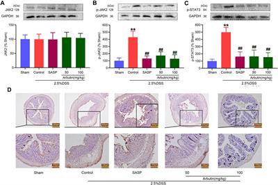 Arbutin Ameliorates Murine Colitis by Inhibiting JAK2 Signaling Pathway